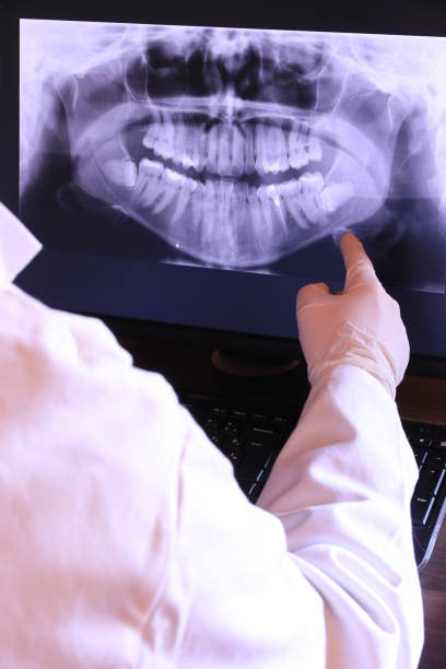 Best Emergency Tooth Extraction in Newberry, FL