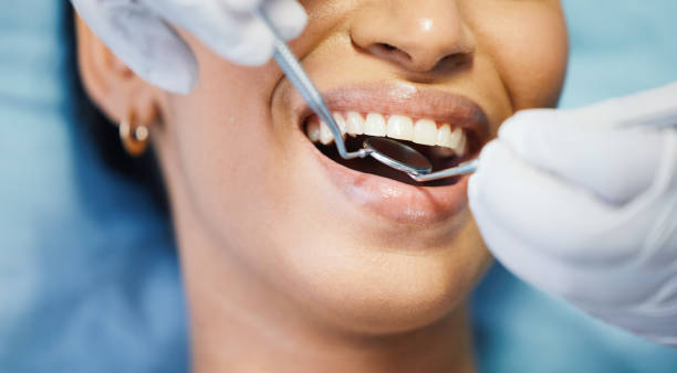 Best Emergency Tooth Extraction in Newberry, FL